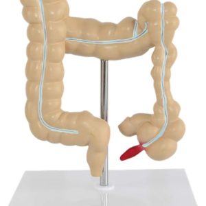 Human Intestine Model Large Intestine Model-Lesion Model-With Base-Removable-Medical Research-25 * 15 * 14Cm